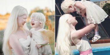 Красивые альбиносы