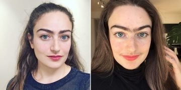 Лишние волосы