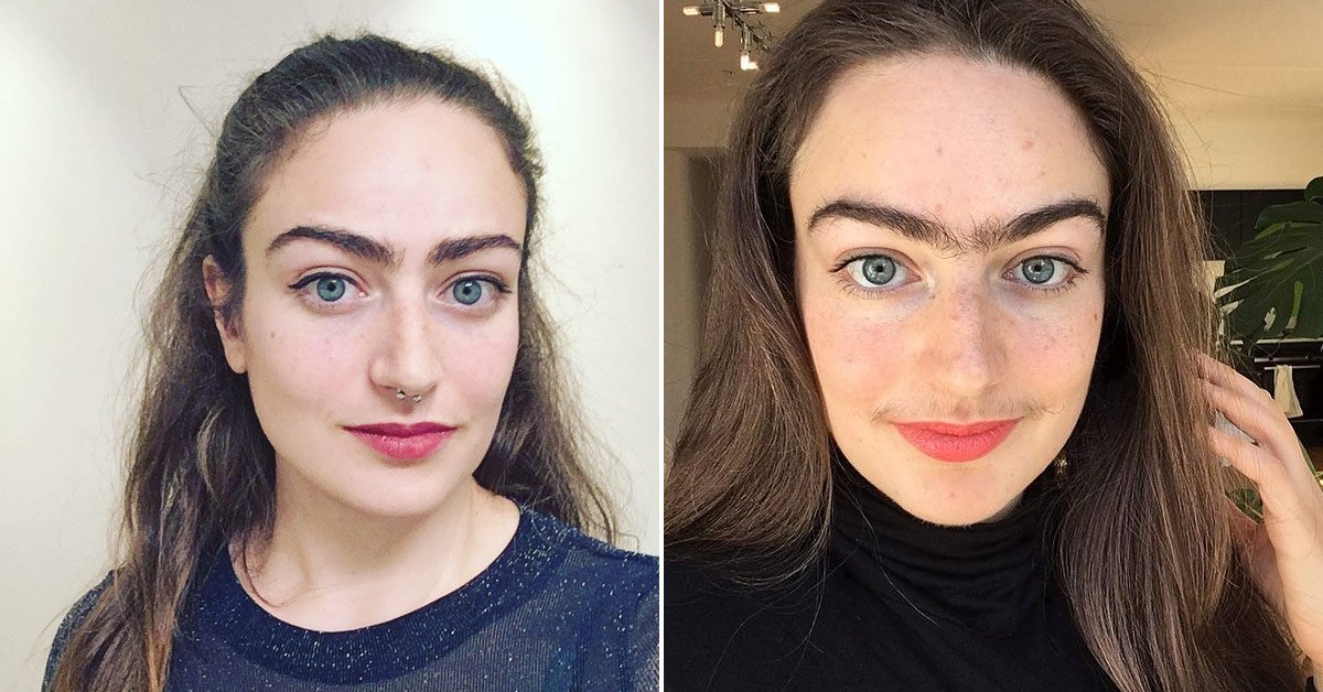 Лишние волосы